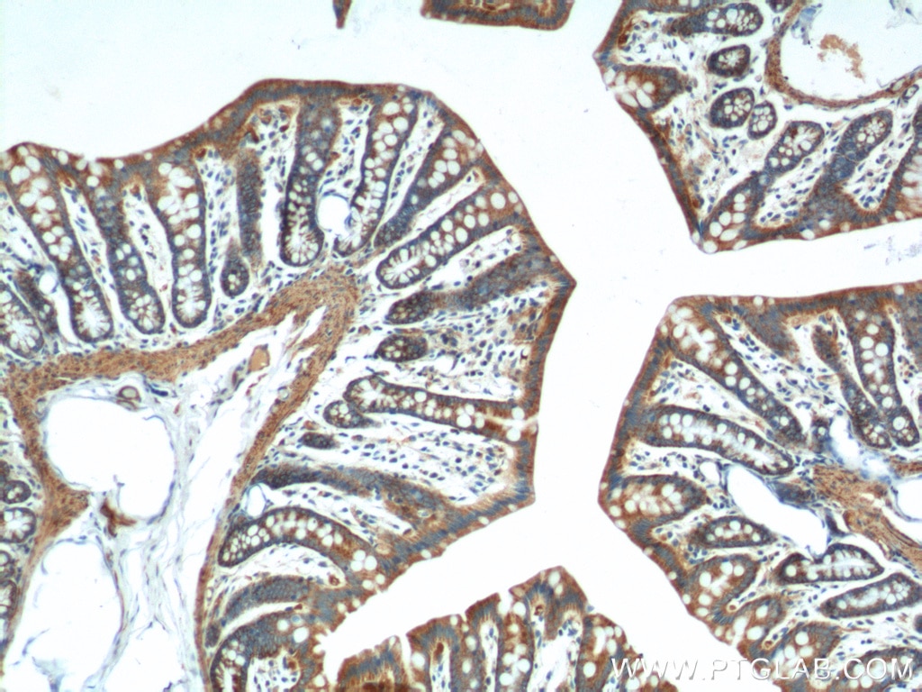 Immunohistochemistry (IHC) staining of rat colon tissue using FSTL1 Polyclonal antibody (20182-1-AP)