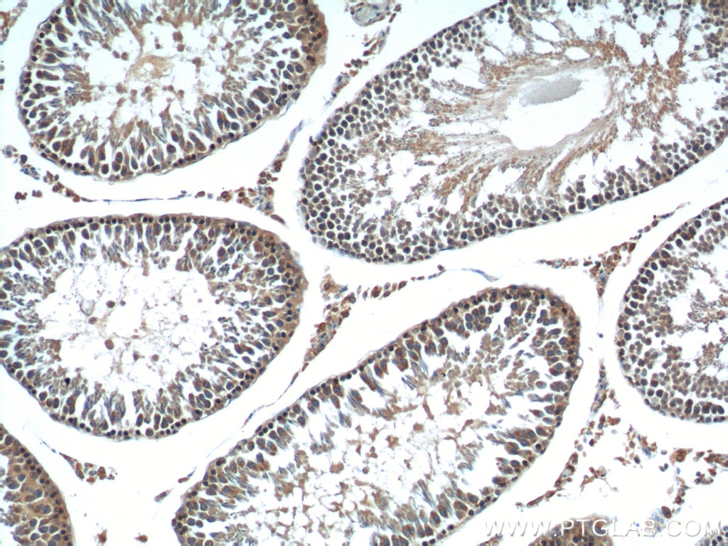 Immunohistochemistry (IHC) staining of rat testis tissue using FSTL1 Polyclonal antibody (20182-1-AP)