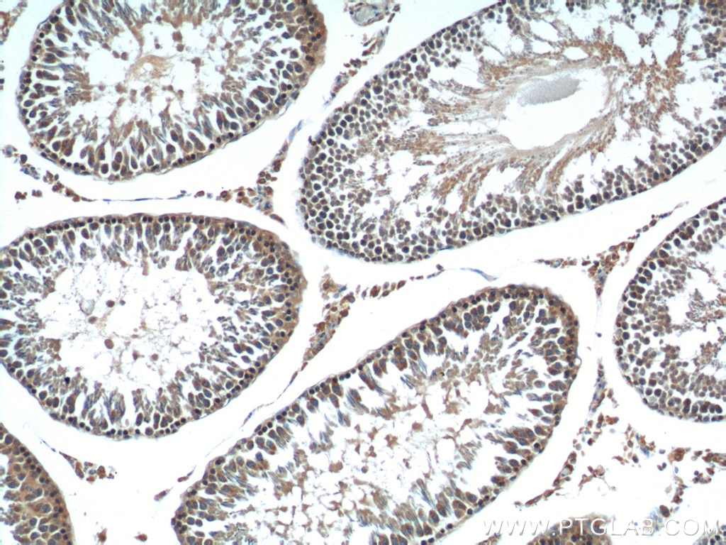 IHC staining of rat testis using 20182-1-AP