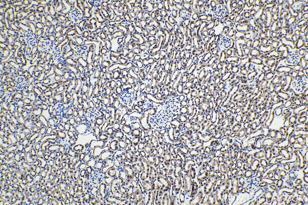 Immunohistochemistry (IHC) staining of mouse kidney tissue using FSTL3 Polyclonal antibody (28218-1-AP)