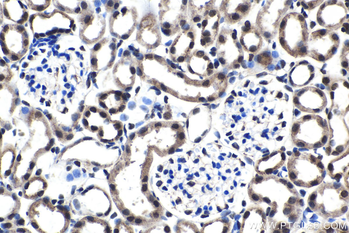 Immunohistochemistry (IHC) staining of mouse kidney tissue using FSTL3 Polyclonal antibody (28218-1-AP)