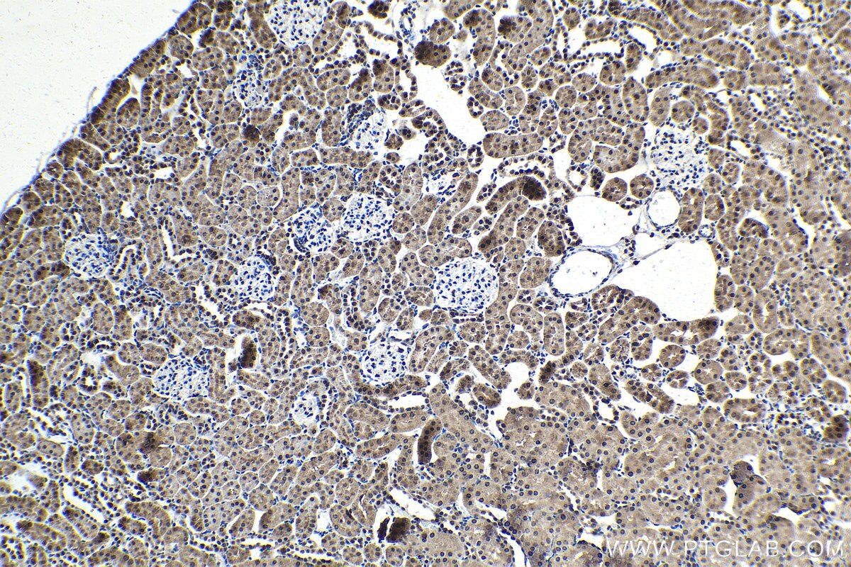 Immunohistochemistry (IHC) staining of rat kidney tissue using FSTL3 Polyclonal antibody (28218-1-AP)
