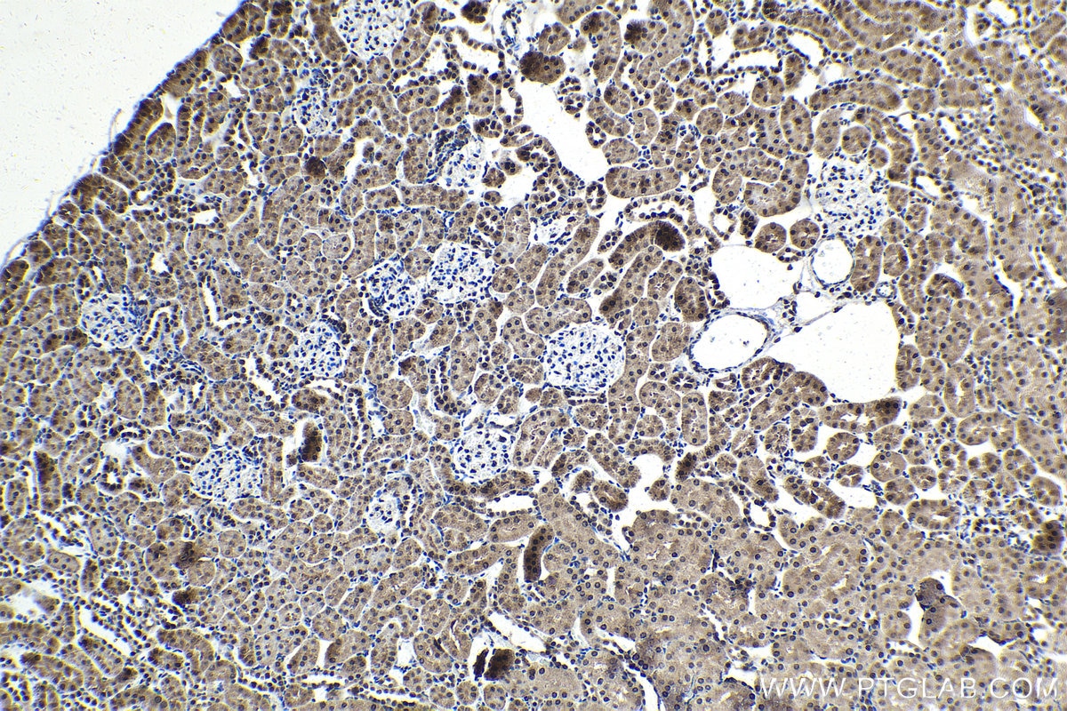 IHC staining of rat kidney using 28218-1-AP