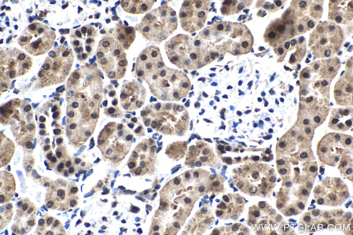 Immunohistochemistry (IHC) staining of rat kidney tissue using FSTL3 Polyclonal antibody (28218-1-AP)