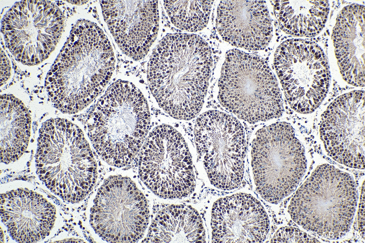 IHC staining of rat testis using 28218-1-AP