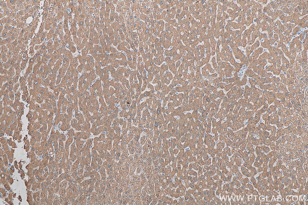 Immunohistochemistry (IHC) staining of human liver tissue using FTCD Polyclonal antibody (21959-1-AP)