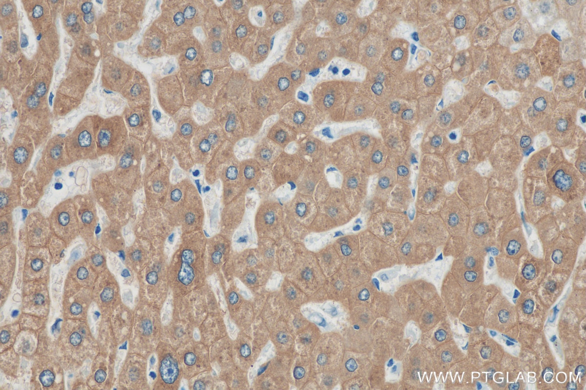 Immunohistochemistry (IHC) staining of human liver tissue using FTCD Polyclonal antibody (21959-1-AP)