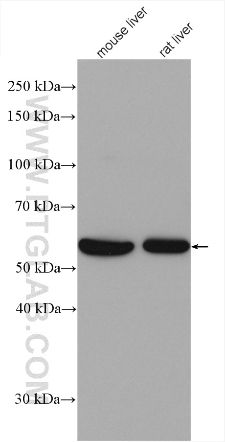 Western Blot (WB) analysis of various lysates using FTCD Polyclonal antibody (21959-1-AP)