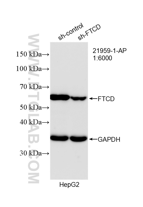 WB analysis of HepG2 using 21959-1-AP Western Blot (WB) analysis of HepG2 cells using FTCD Polyclonal antibody (21959-1-AP)