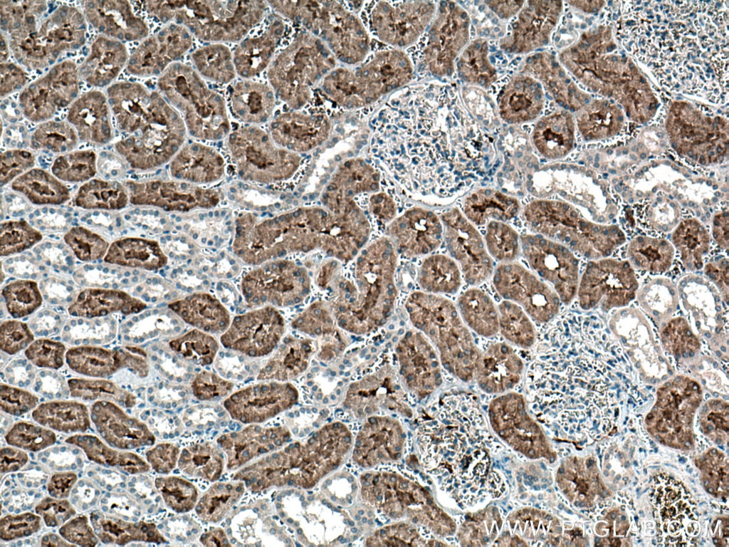 Immunohistochemistry (IHC) staining of human kidney tissue using FTCD Monoclonal antibody (66979-1-Ig)
