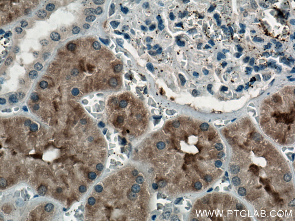 Immunohistochemistry (IHC) staining of human kidney tissue using FTCD Monoclonal antibody (66979-1-Ig)