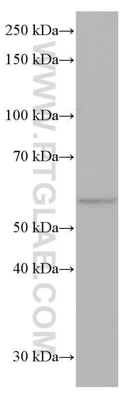 Western Blot (WB) analysis of pig kidney tissue using FTCD Monoclonal antibody (66979-1-Ig)