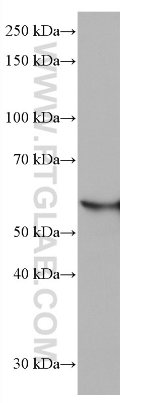 Western Blot (WB) analysis of pig liver tissue using FTCD Monoclonal antibody (66979-1-Ig)