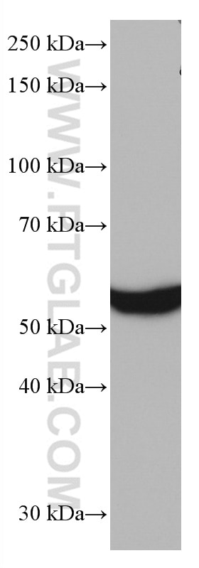 Western Blot (WB) analysis of mouse liver tissue using FTCD Monoclonal antibody (66979-1-Ig)