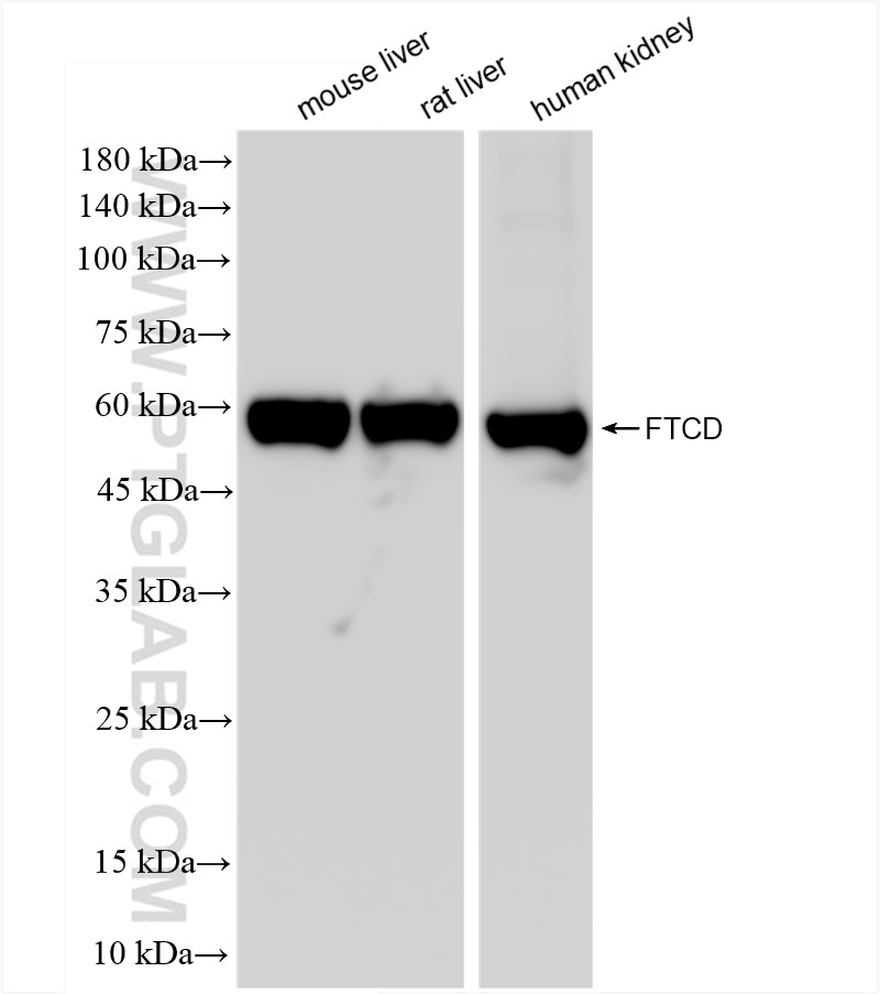Western Blot (WB) analysis of various lysates using FTCD Recombinant antibody (83664-2-RR)