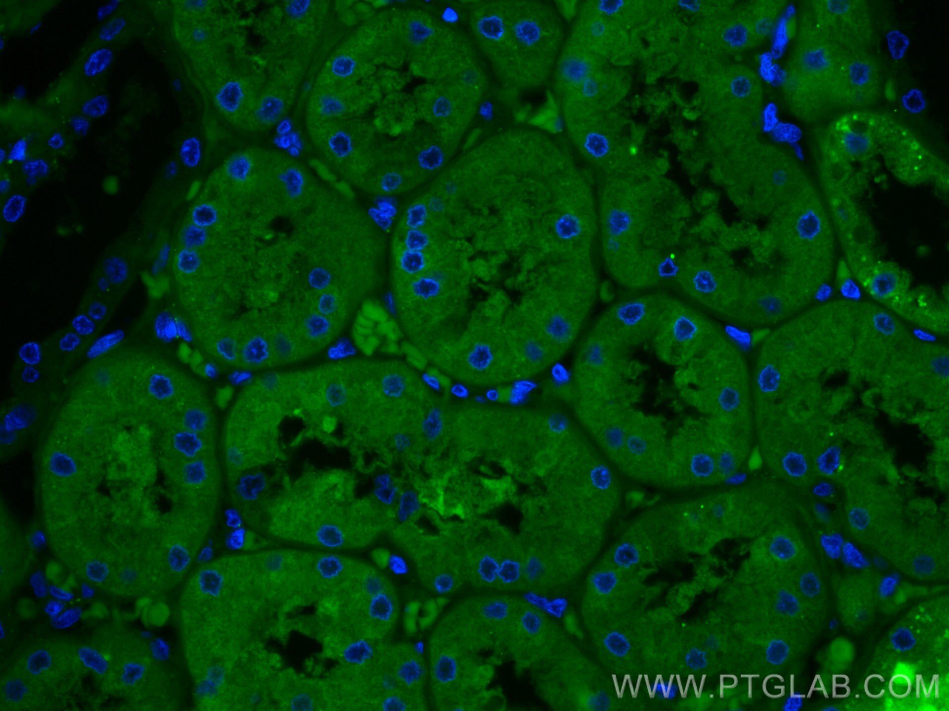 Immunofluorescence (IF) / fluorescent staining of human kidney tissue using CoraLite® Plus 488-conjugated FTCD Monoclonal anti (CL488-66979)