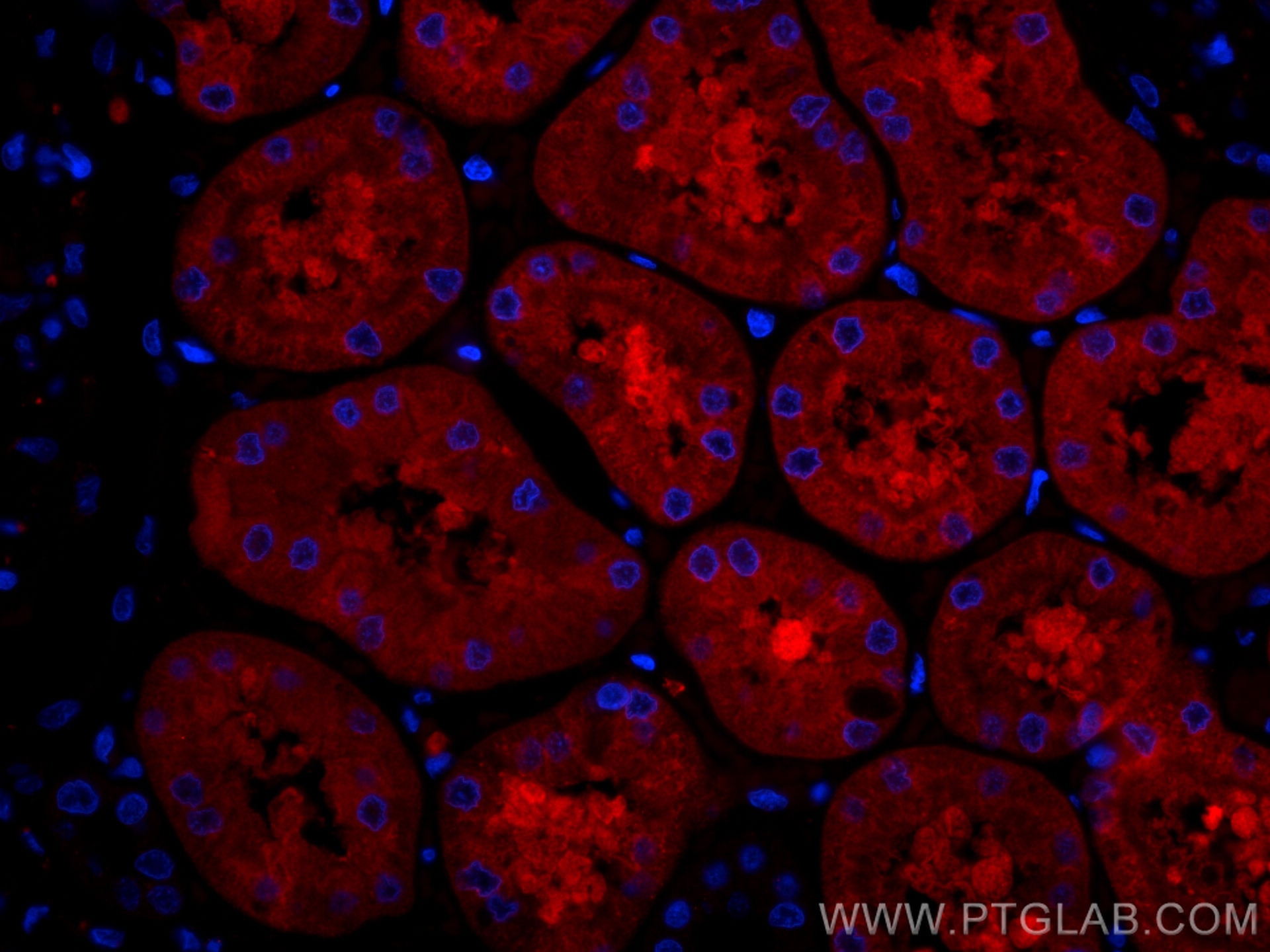 Immunofluorescence (IF) / fluorescent staining of human kidney tissue using CoraLite®594-conjugated FTCD Monoclonal antibody (CL594-66979)