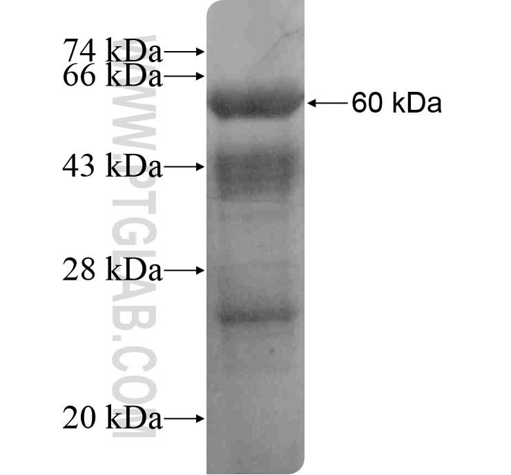 FTCD fusion protein Ag16646 SDS-PAGE