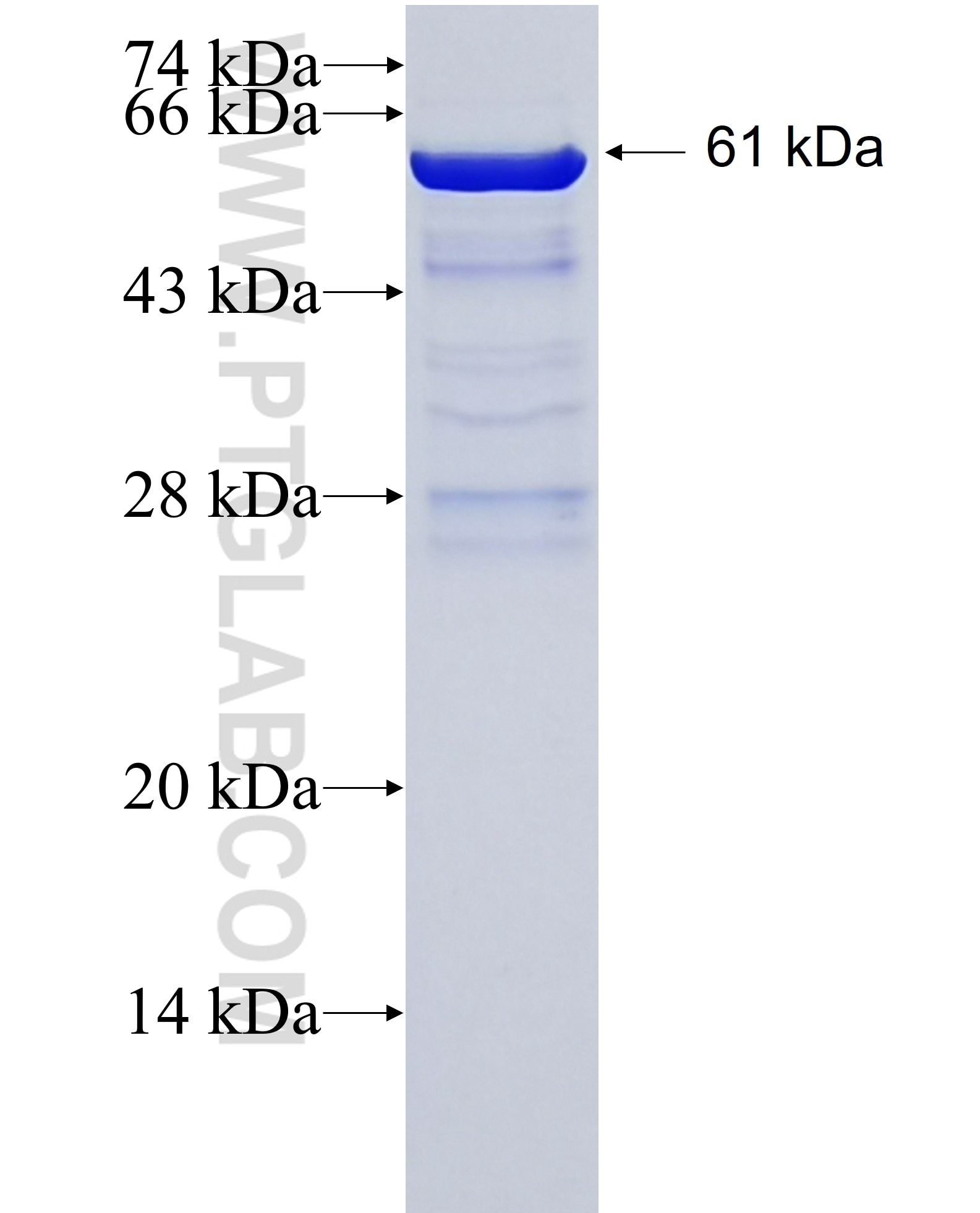 FTCD fusion protein Ag16646 SDS-PAGE