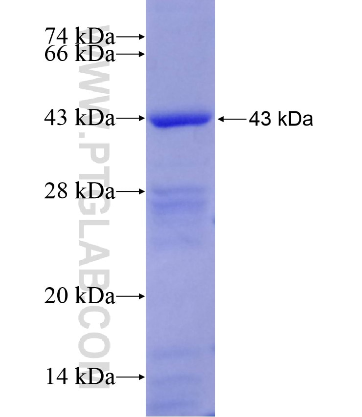 FTCD fusion protein Ag17429 SDS-PAGE