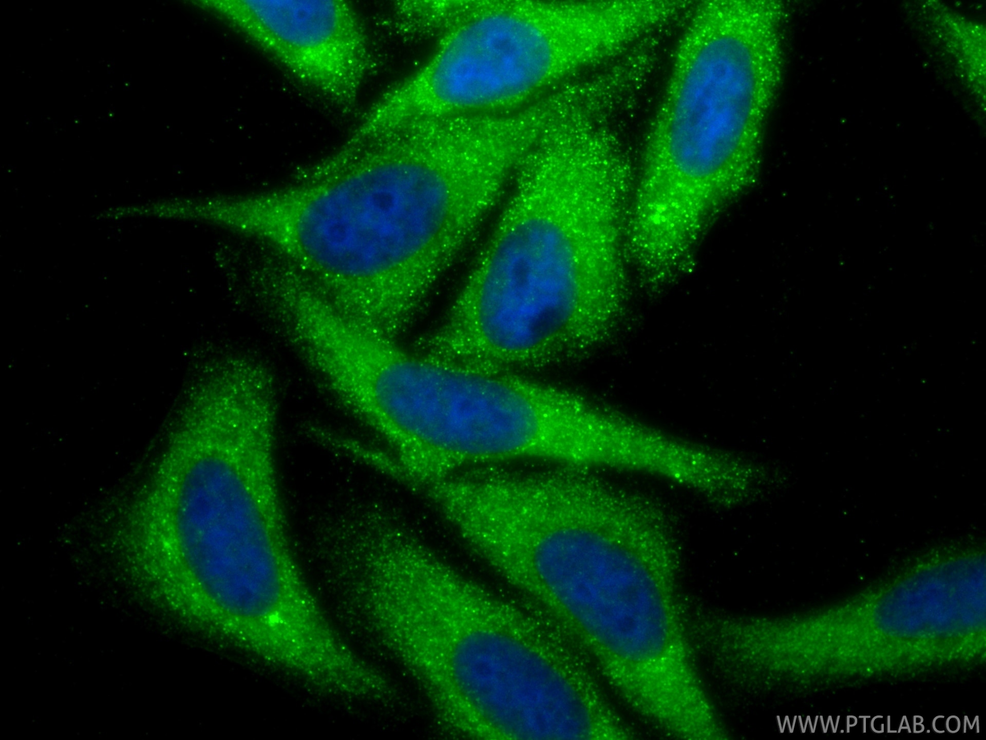 Immunofluorescence (IF) / fluorescent staining of HepG2 cells using Ferritin heavy chain Polyclonal antibody (11682-1-AP)