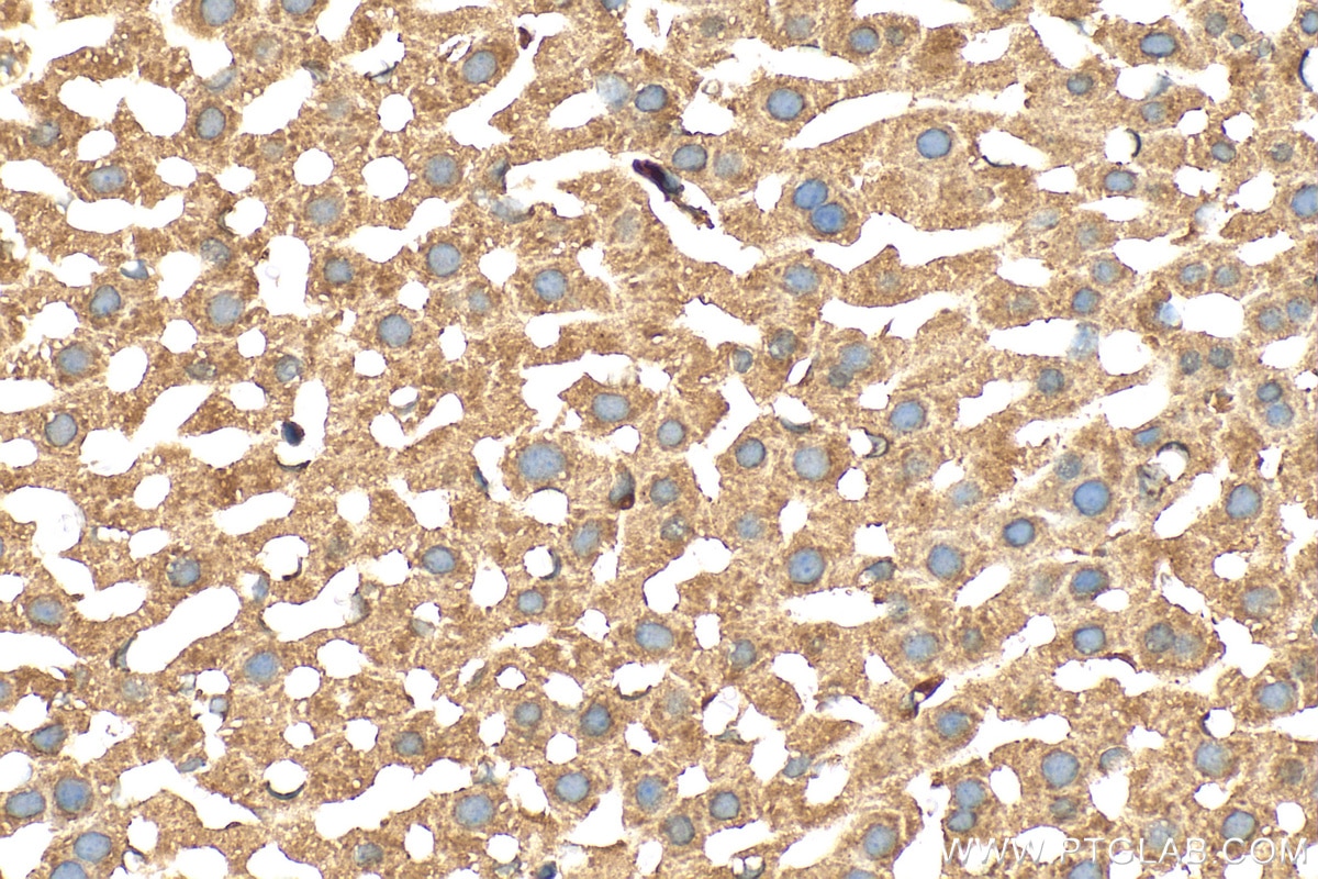 Immunohistochemistry (IHC) staining of mouse liver tissue using Ferritin heavy chain Polyclonal antibody (11682-1-AP)