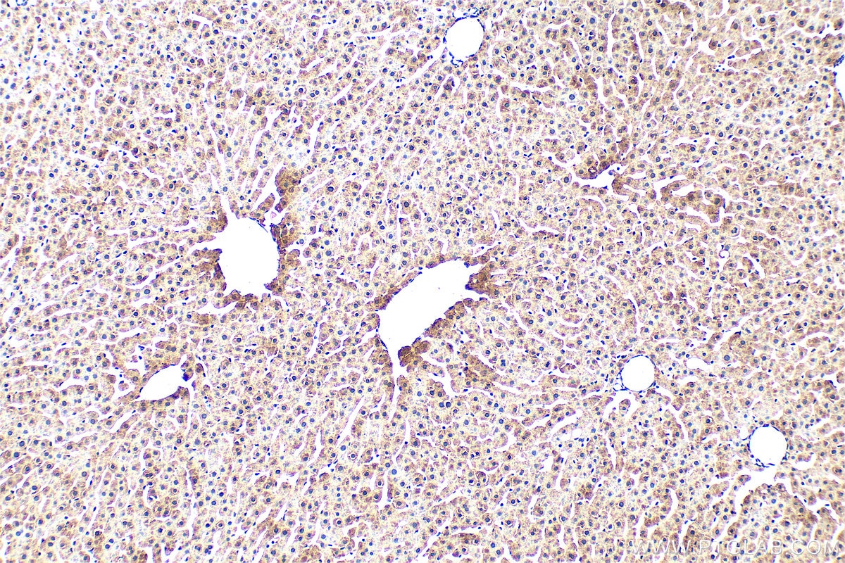 Immunohistochemistry (IHC) staining of rat liver tissue using Ferritin heavy chain Polyclonal antibody (11682-1-AP)