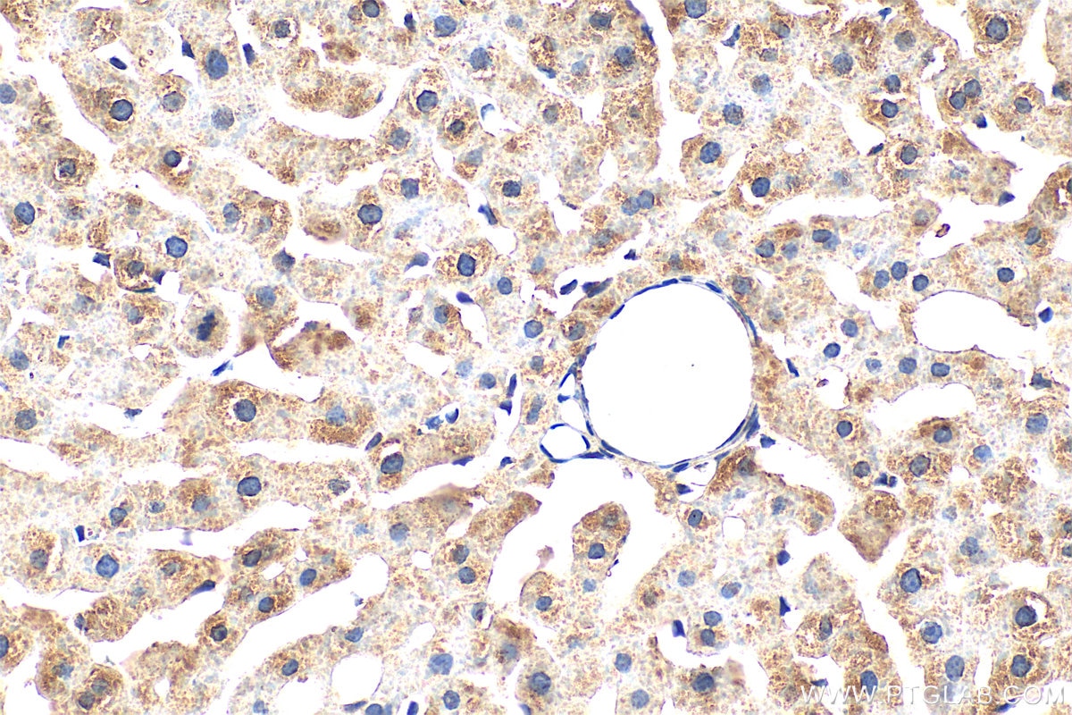 Immunohistochemistry (IHC) staining of rat liver tissue using Ferritin heavy chain Polyclonal antibody (11682-1-AP)