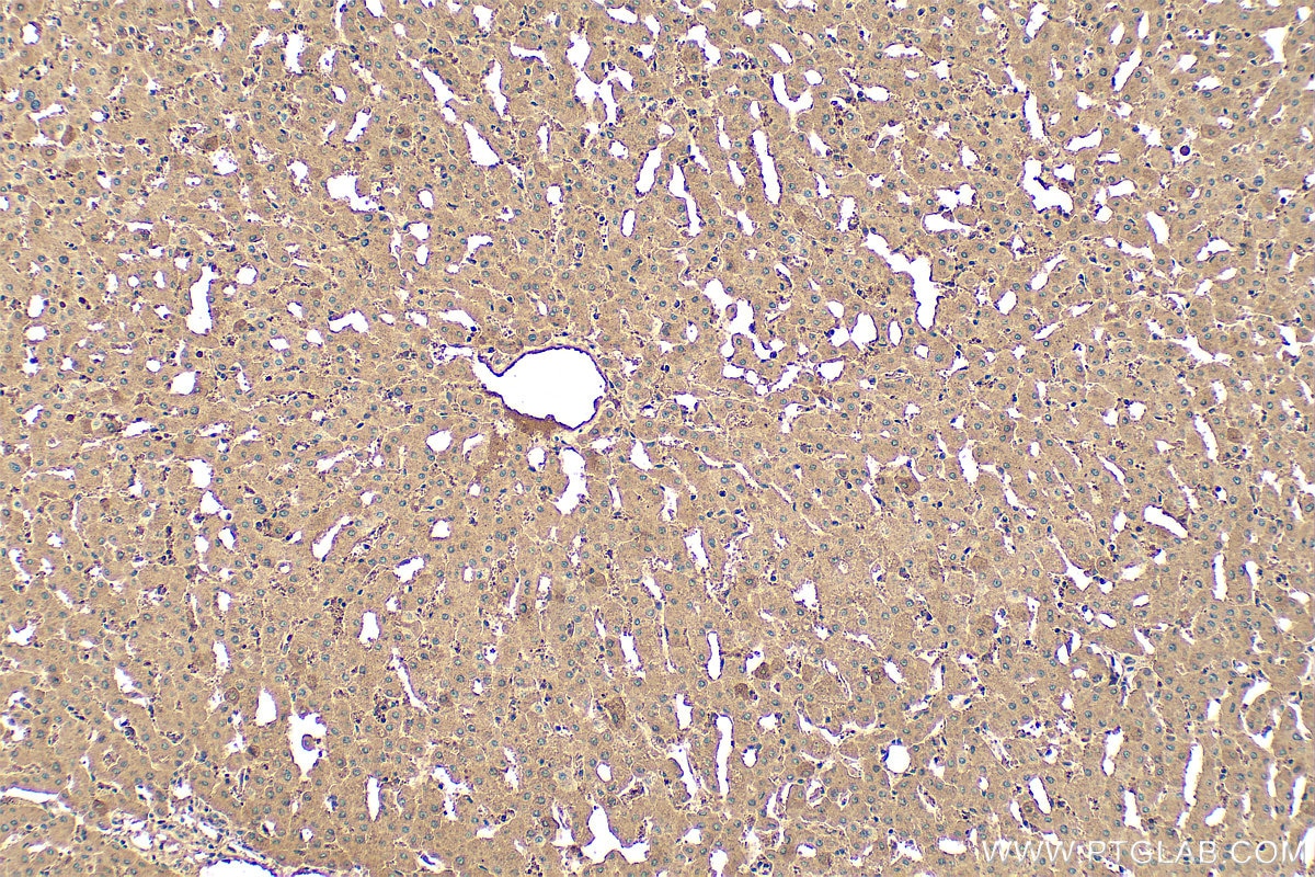 Immunohistochemistry (IHC) staining of human liver tissue using Ferritin heavy chain Polyclonal antibody (11682-1-AP)