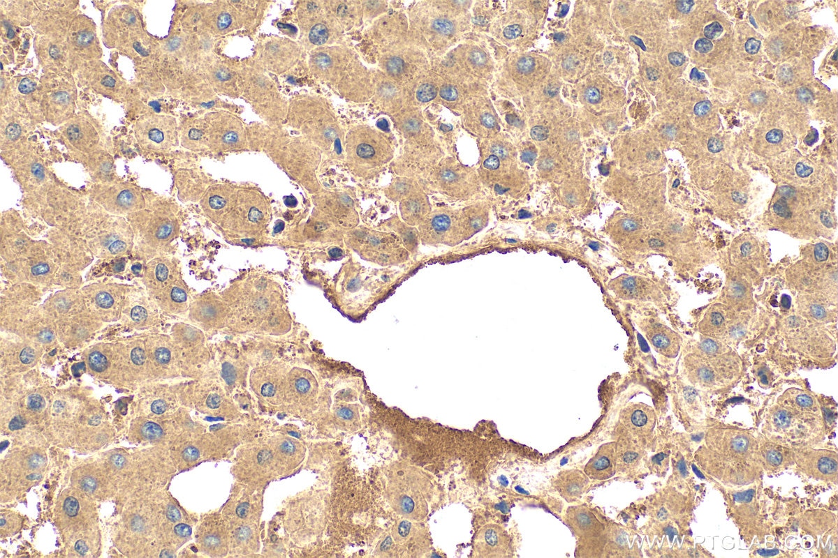 Immunohistochemistry (IHC) staining of human liver tissue using Ferritin heavy chain Polyclonal antibody (11682-1-AP)