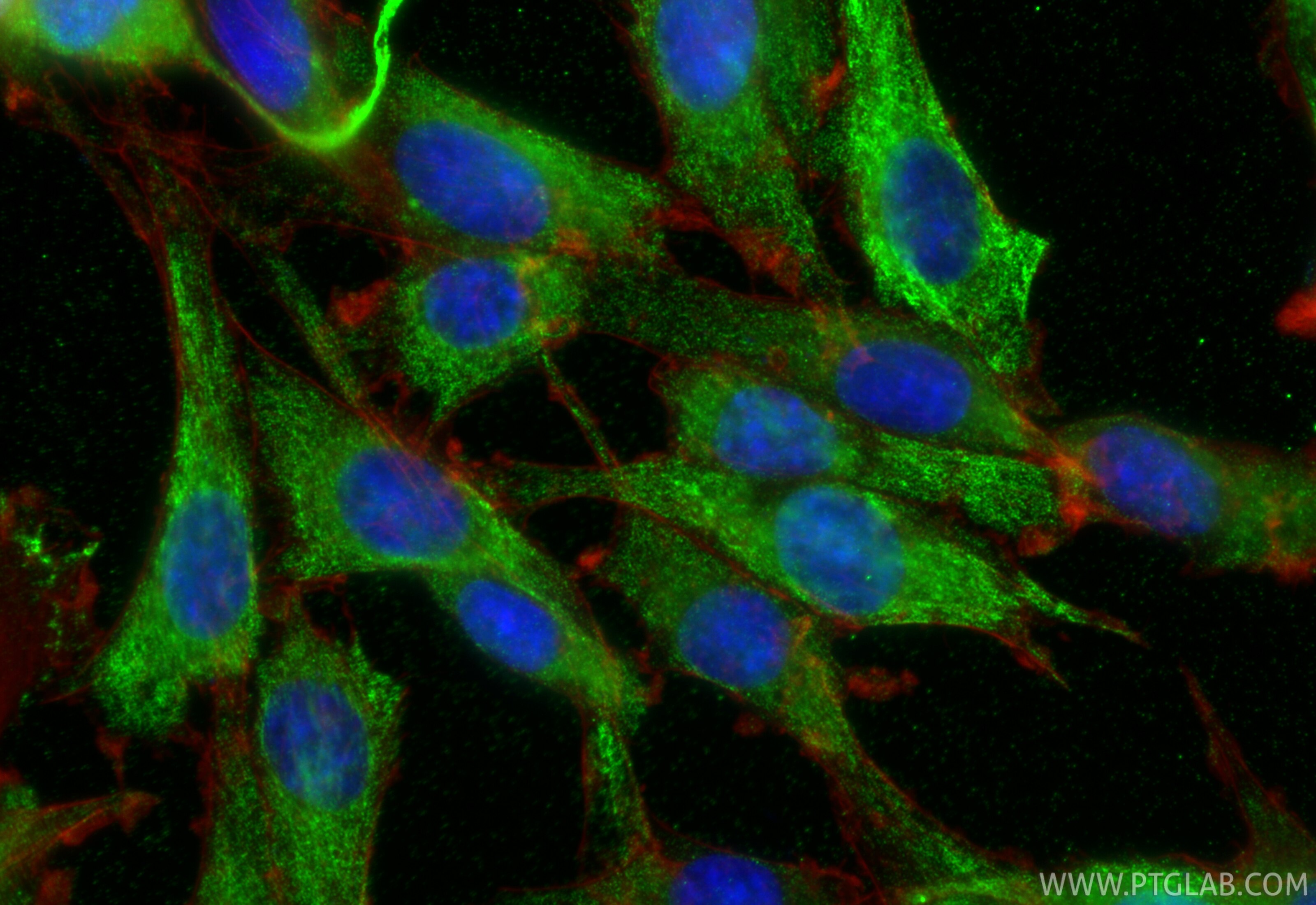 Immunofluorescence (IF) / fluorescent staining of C6 cells using Ferritin heavy chain Monoclonal antibody (60875-5-Ig)
