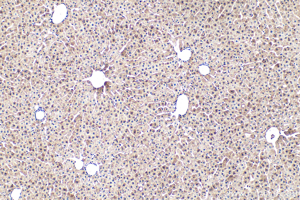 Immunohistochemistry (IHC) staining of rat liver tissue using Ferritin heavy chain Monoclonal antibody (60875-5-Ig)