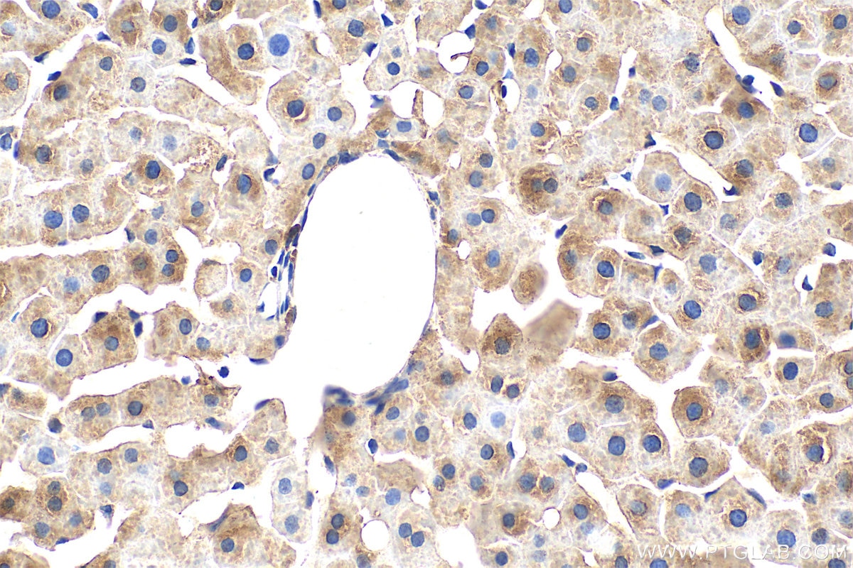 Immunohistochemistry (IHC) staining of rat liver tissue using Ferritin heavy chain Monoclonal antibody (60875-5-Ig)