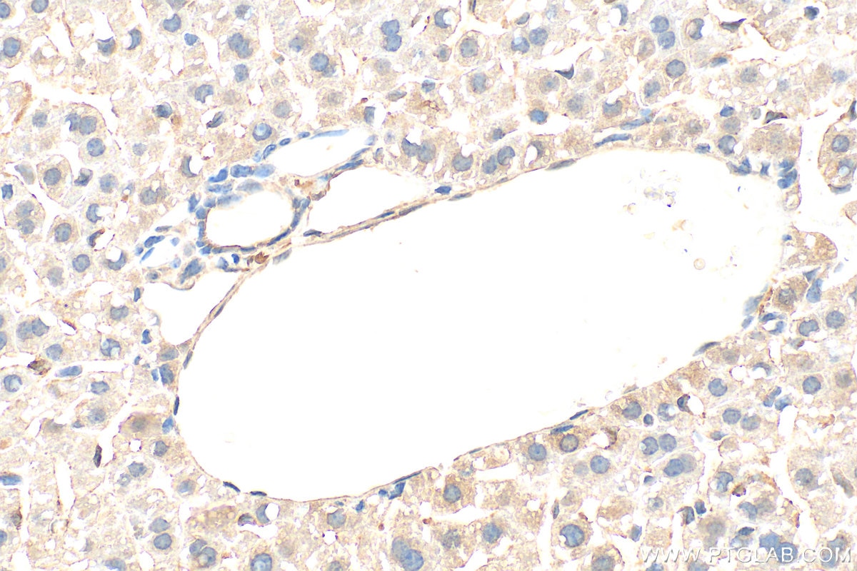 Immunohistochemical analysis of paraffin-embedded mouse liver tissue slide using 60875-5-Ig (Ferritin heavy chain antibody) at dilution of 1:500 (under 40x lens). Heat mediated antigen retrieval with Tris-EDTA buffer (pH 9.0). Immunohistochemistry (IHC) staining of mouse liver tissue using Ferritin heavy chain Monoclonal antibody (60875-5-Ig)