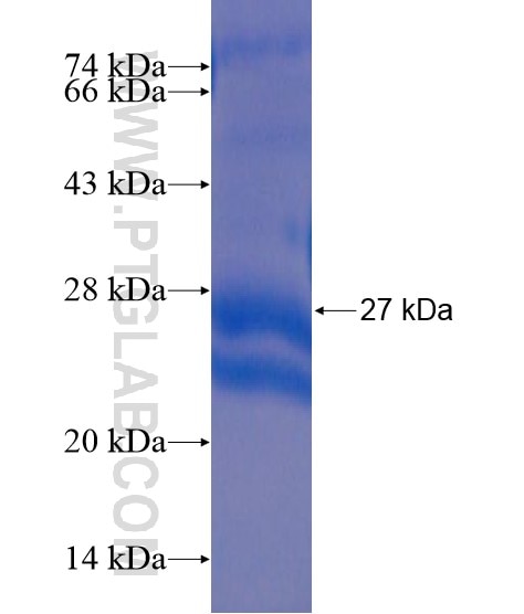 FTH1 fusion protein Ag21386 SDS-PAGE