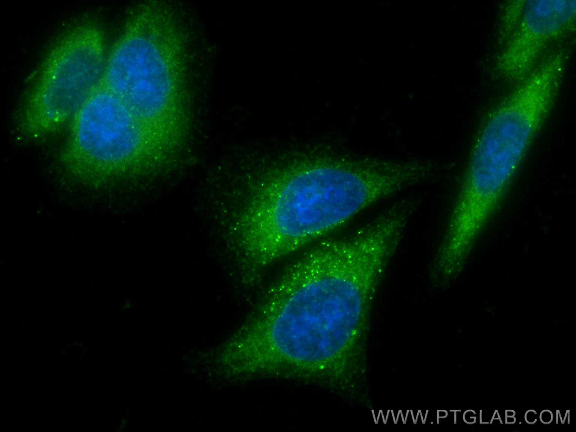 Ferritin light chain