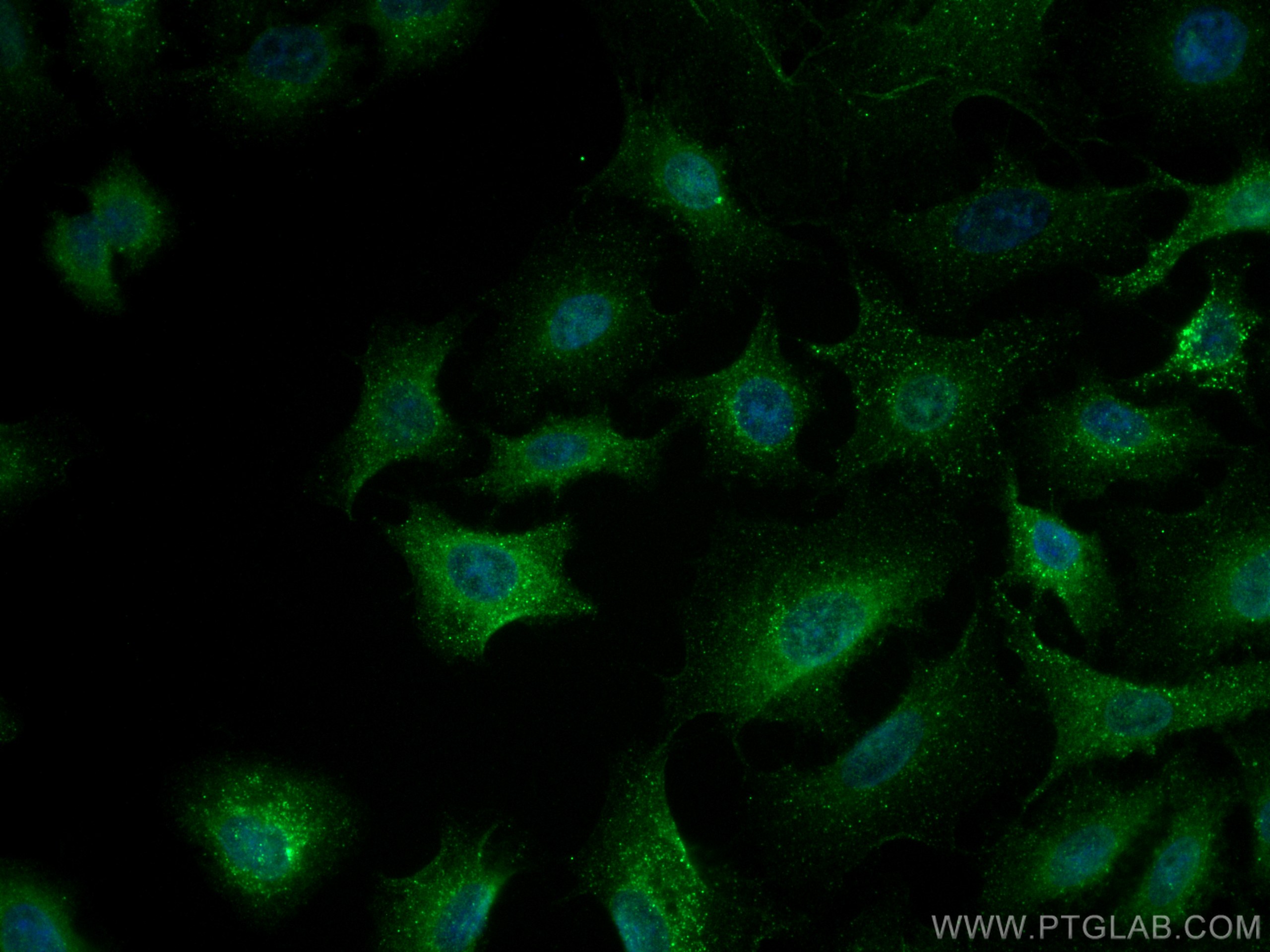 Immunofluorescence (IF) / fluorescent staining of A549 cells using Ferritin light chain Polyclonal antibody (10727-1-AP)