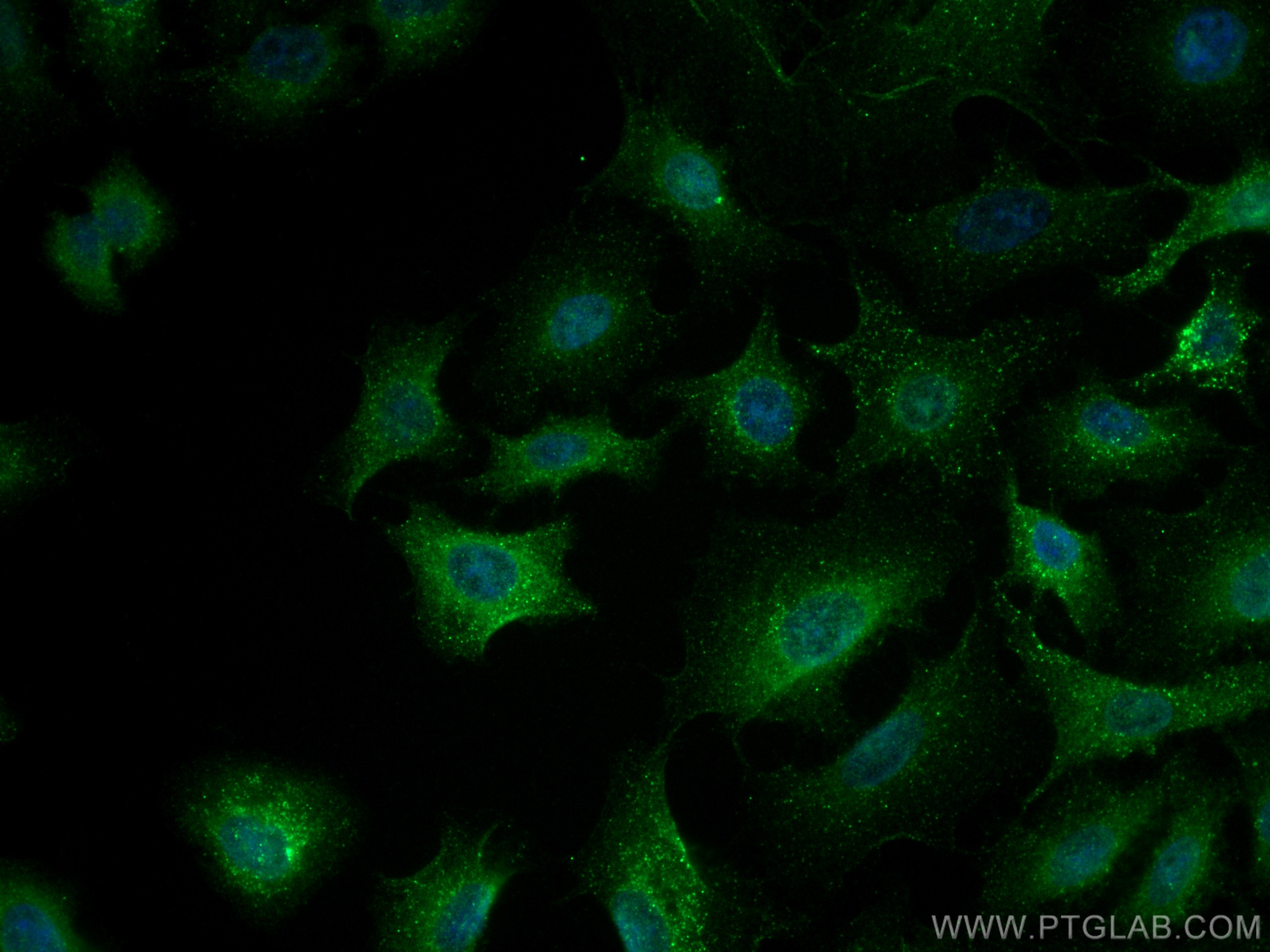 IF Staining of A549 using 10727-1-AP