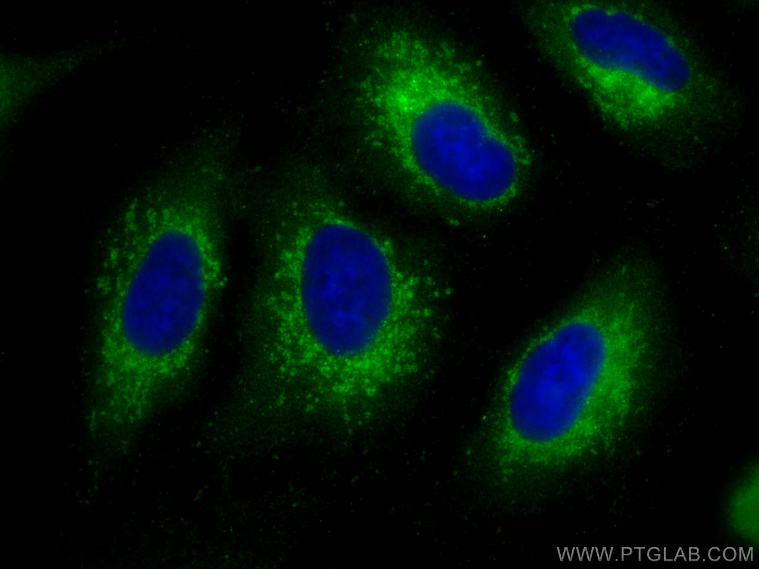 Immunofluorescence (IF) / fluorescent staining of A549 cells using Ferritin light chain Polyclonal antibody (10727-1-AP)