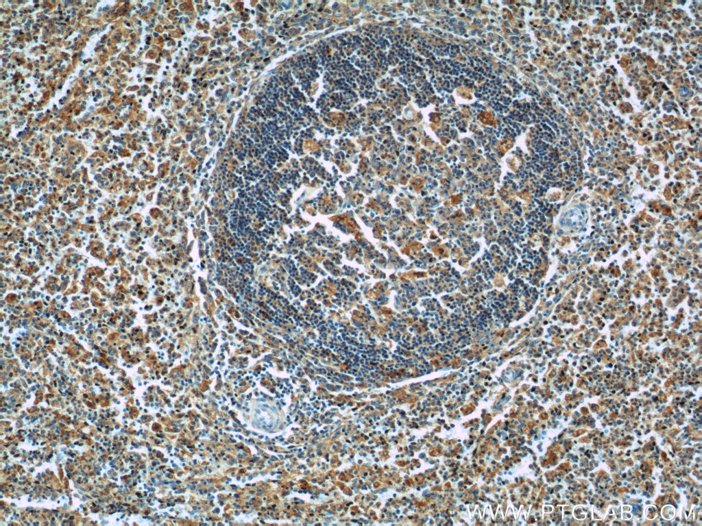 Immunohistochemistry (IHC) staining of human spleen tissue using Ferritin light chain Polyclonal antibody (10727-1-AP)