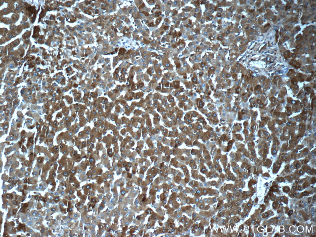 Ferritin light chain Polyclonal antibody