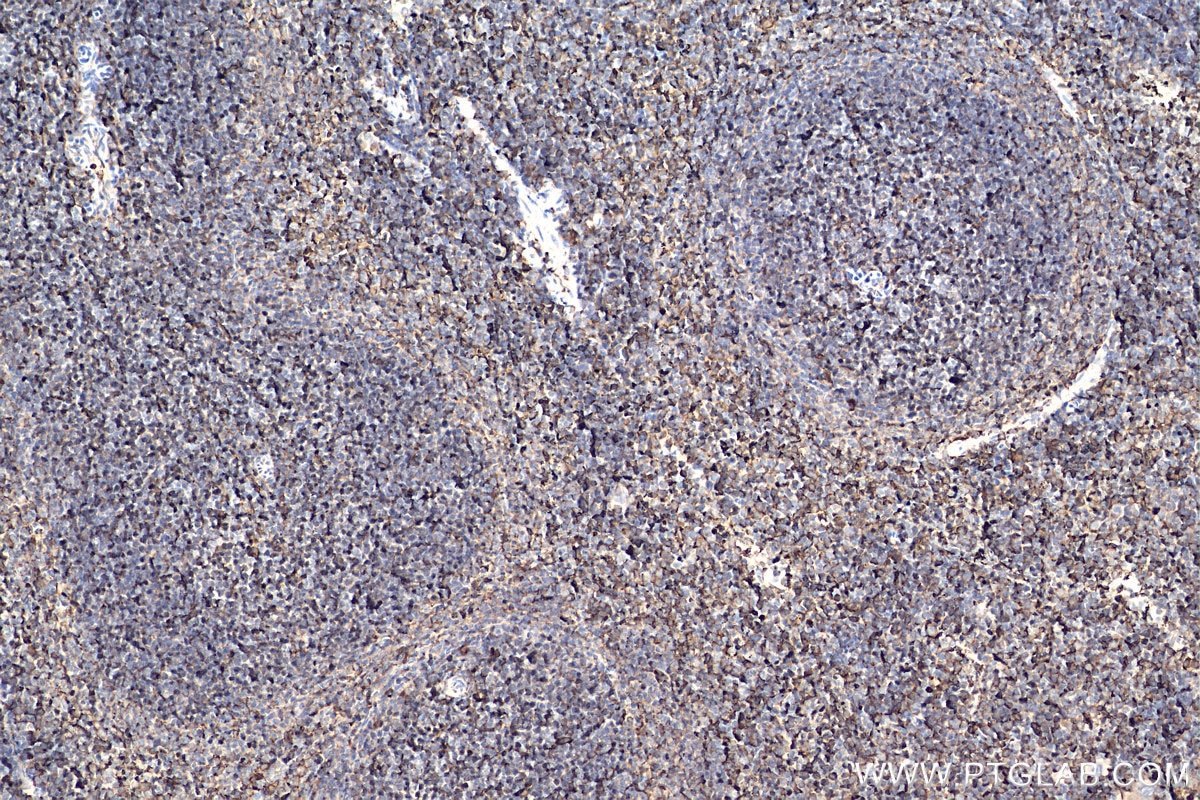 Immunohistochemistry (IHC) staining of mouse spleen tissue using Ferritin light chain Polyclonal antibody (10727-1-AP)