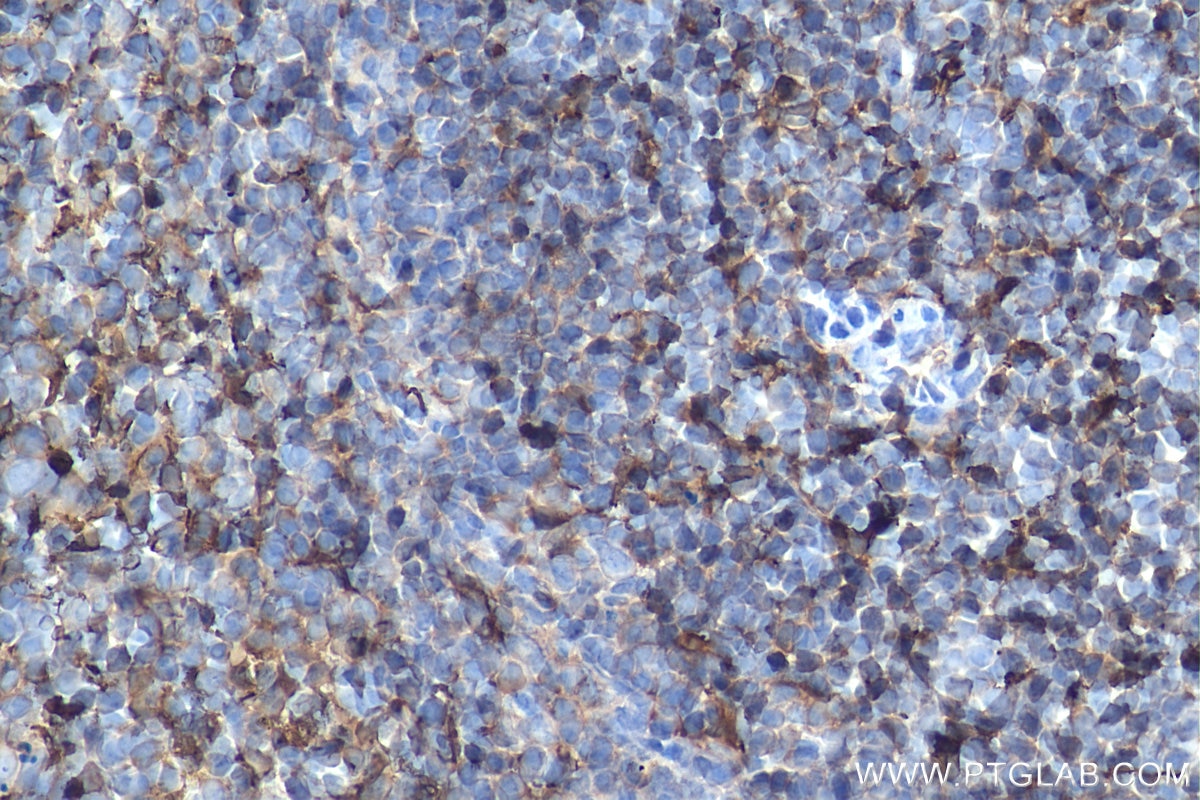 Immunohistochemistry (IHC) staining of mouse spleen tissue using Ferritin light chain Polyclonal antibody (10727-1-AP)