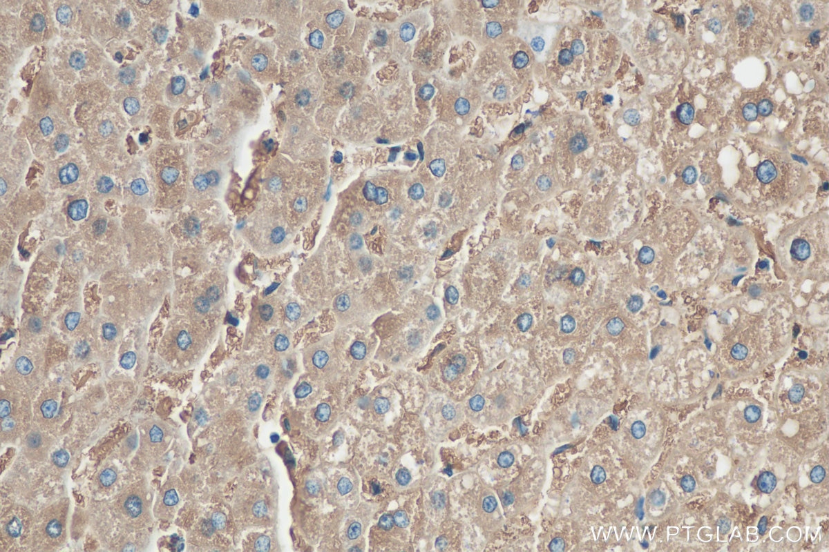 Immunohistochemistry (IHC) staining of human liver tissue using Ferritin light chain Polyclonal antibody (10727-1-AP)
