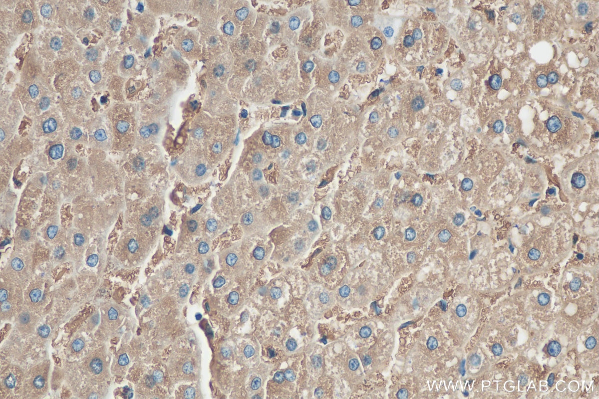 IHC staining of human liver using 10727-1-AP