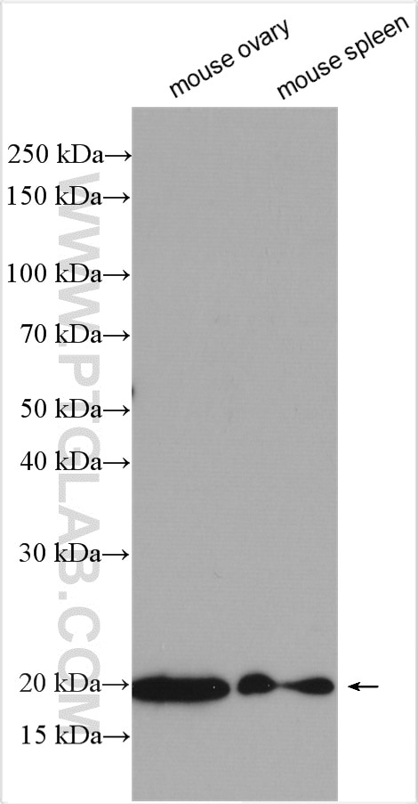 Western Blot (WB) analysis of various lysates using Ferritin light chain Polyclonal antibody (10727-1-AP)