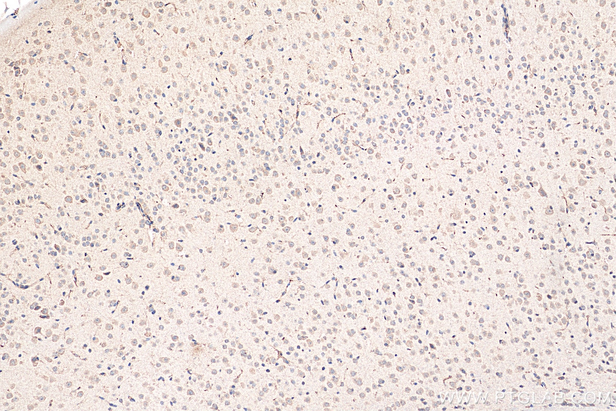 Immunohistochemistry (IHC) staining of mouse brain tissue using Ferritin light chain Monoclonal antibody (68068-1-Ig)