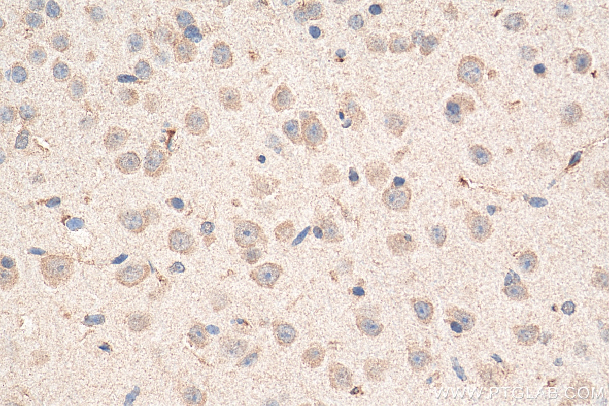 IHC staining of mouse brain using 68068-1-Ig