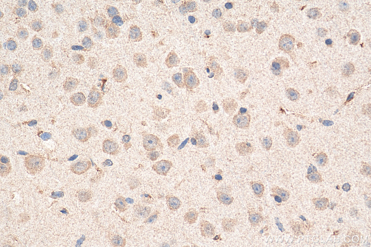 Immunohistochemistry (IHC) staining of mouse brain tissue using Ferritin light chain Monoclonal antibody (68068-1-Ig)