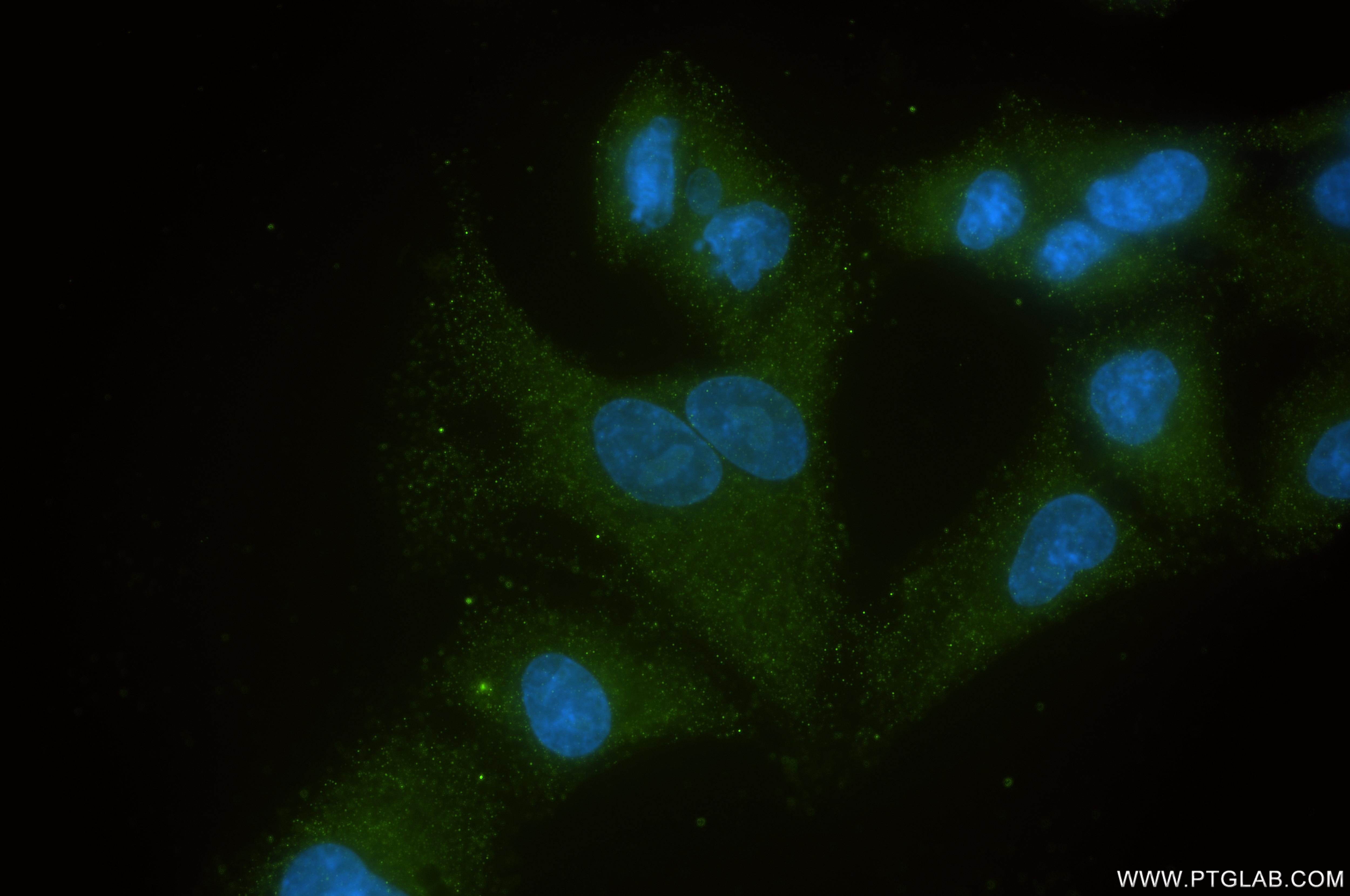 Immunofluorescence (IF) / fluorescent staining of A549 cells using FTL Recombinant antibody (81166-3-RR)